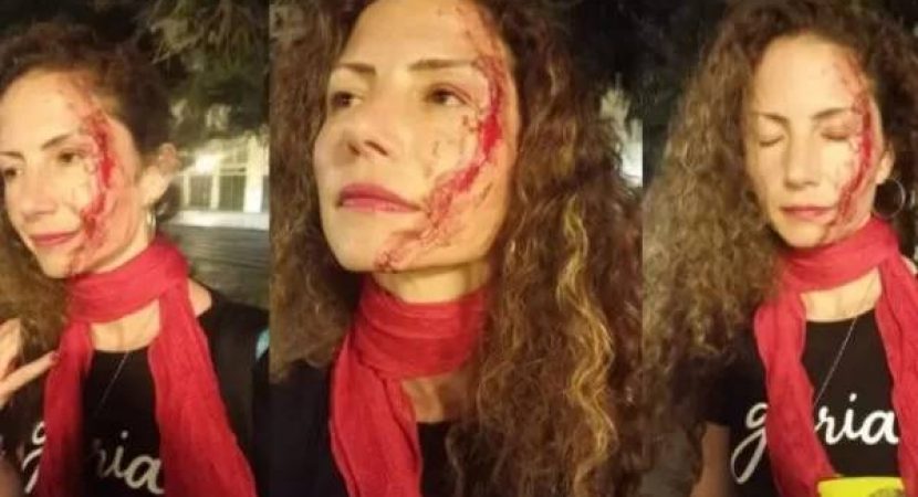 Jornalista da CNN com adesivo do Lula é espancada em Curitiba